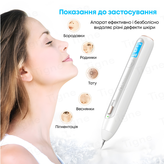 Коагулятор для удаления папиллом и бородавок XPREEN XPRE051 ...
