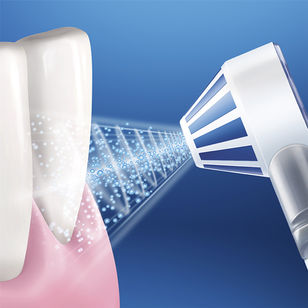 Іригатор Oral-B Aquacare 4 (4210201233404) - зображення 6