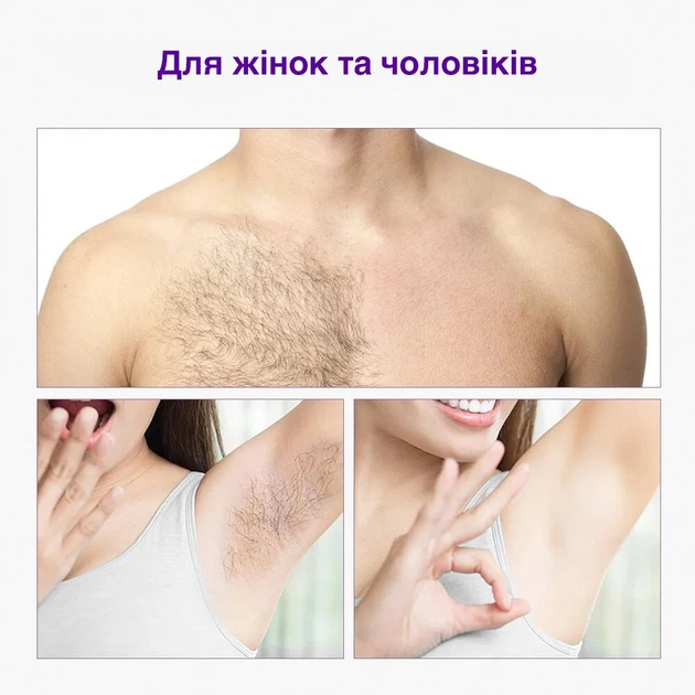 Фотоепілятор Hailicare для видалення волосся білий (72930175) - зображення 6