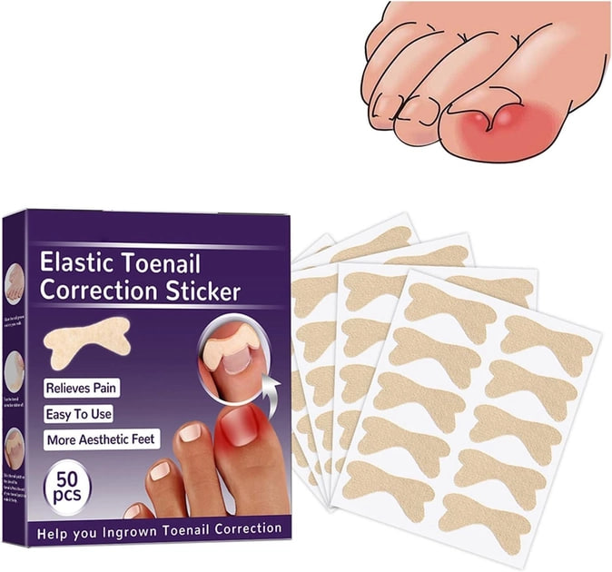 Набір пластирів 50шт від врослих нігтів для корекції та усунення врослих нігтів Elastic Toenail Correction Sticker - зображення 2