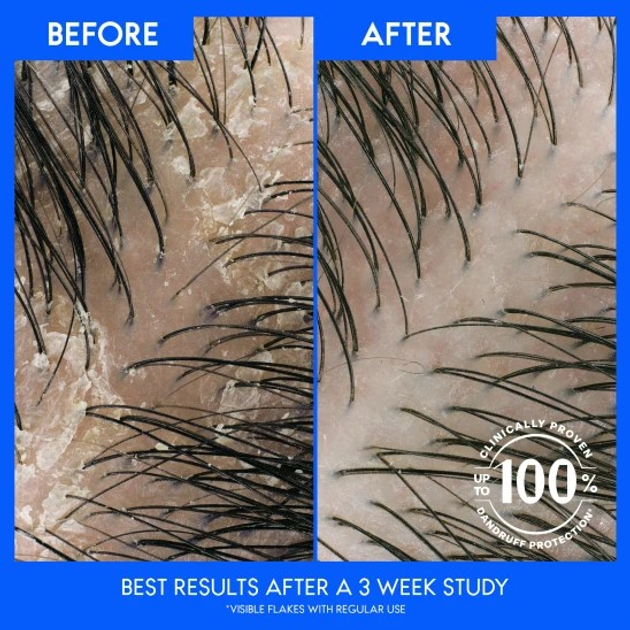 Шампунь від лупи Head & Shoulders Menthol 2в1 330 мл (8700216304825) - зображення 3