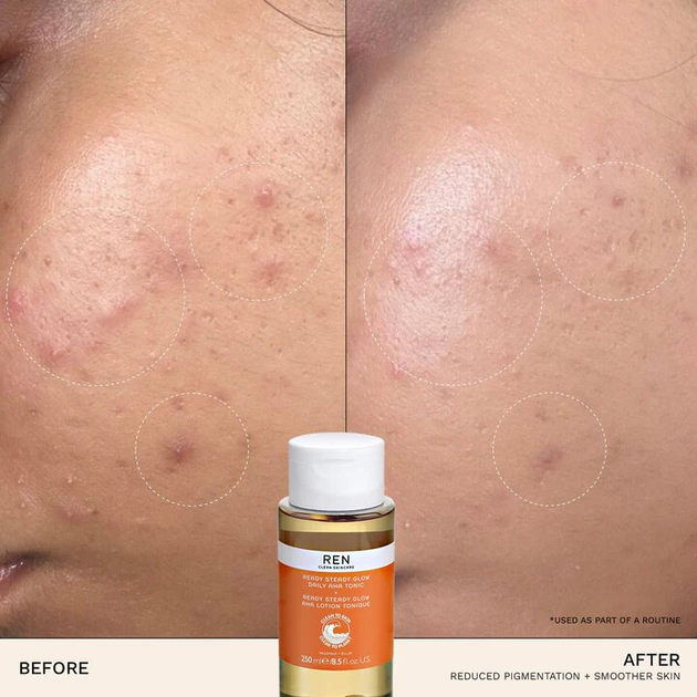 Тонік для обличчя Ren Radiance Ready Steady Glow Daily AHA 250 мл (5060389246951) - зображення 3