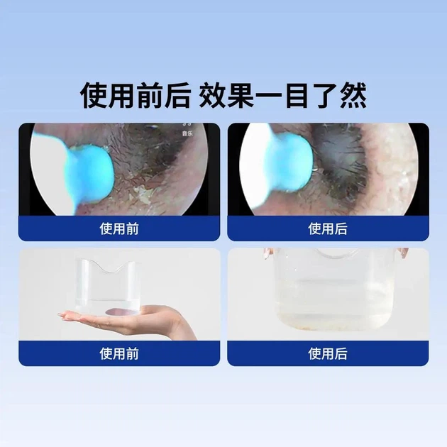 Прибор для промывки ушей DOCO Electric Ear Cleaner EC001 - изображение 4