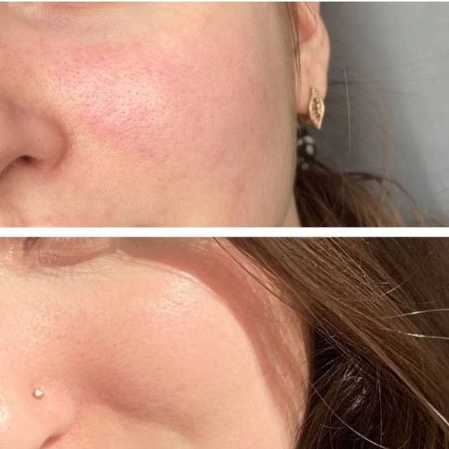 Крем для чувствительной кожи лица с розацеа Eco.prof.cosmetics by Dr.Vashchenko Cream 50 мл - изображение 2