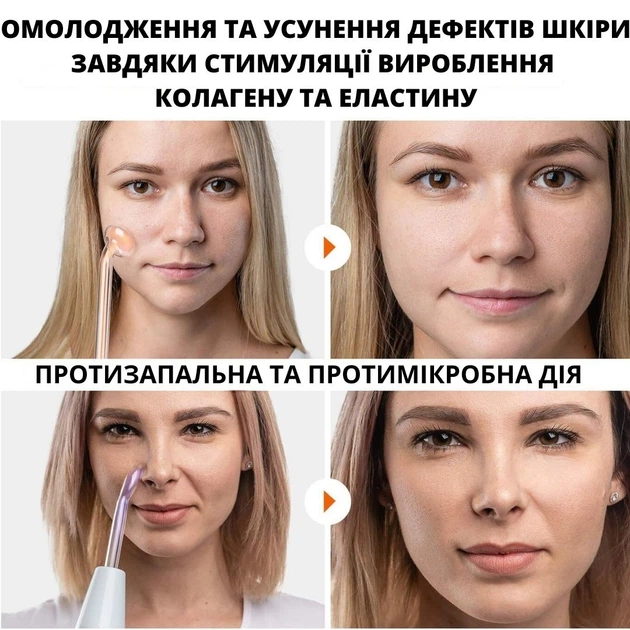 Дарсонваль AIMED Lift Skin Pro Black Edition с 6 насадками Черный