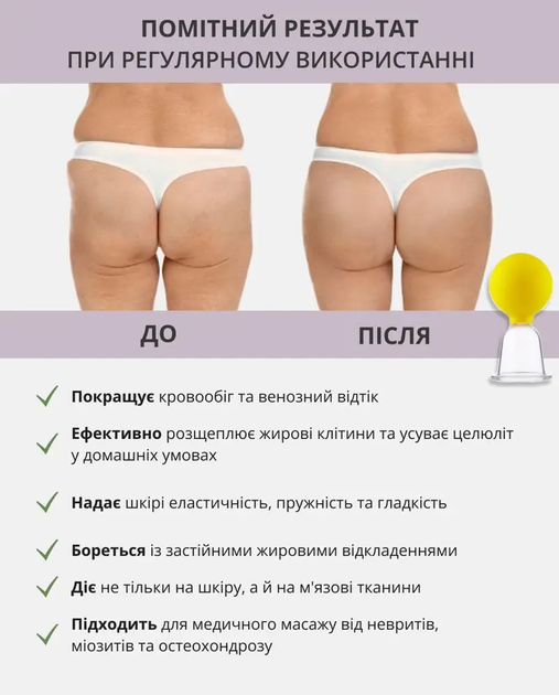 Банку вакуумна масажна - зображення 5