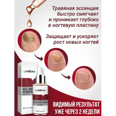 Противогрибковое средство для ногтей на руках и ногах LANBENA с пилочкой 15мл (II) 32096 - Фото 4 Противогрибковое средство для ногтей на руках и ногах LANBENA с пилочкой 15мл (II) 32096 - изображение 4
