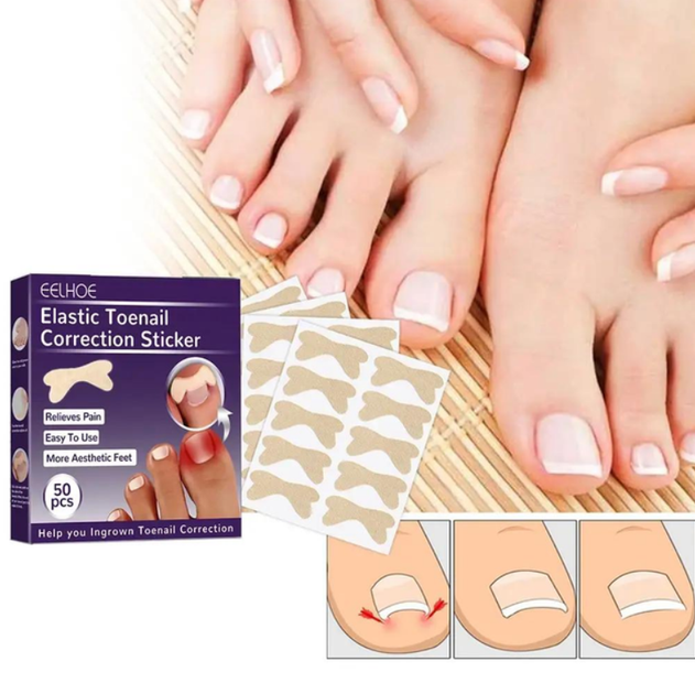 Набір пластирів для корекції нігтів, що вростають Elastic Toenail Correction Sticker (50 pcs) - зображення 1