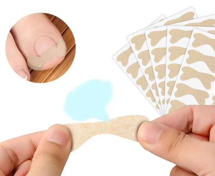 Набор пластырей для коррекции вростающих ногтей Elastic Toenail Correction Sticker (50 pcs) - изображение 2