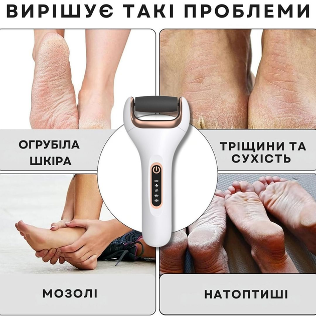 Электрическая роликовая пилка-пемза AIMED Foot Master Classic белый - изображение 3