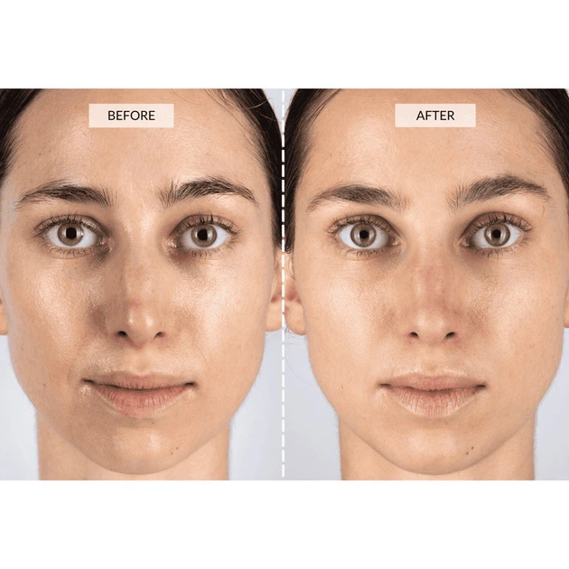 Светодиодная маска CurrentBody Skin Mask LED Visage - изображение 5