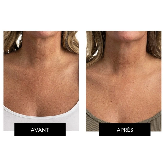 Набор CurrentBody Skin LED Light Therapy Face Neck Kit для лица