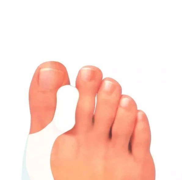 Hallux Toe Spreader - протектор на косточку с перегородкой (арт. PDG-277), Pedag - изображение 2