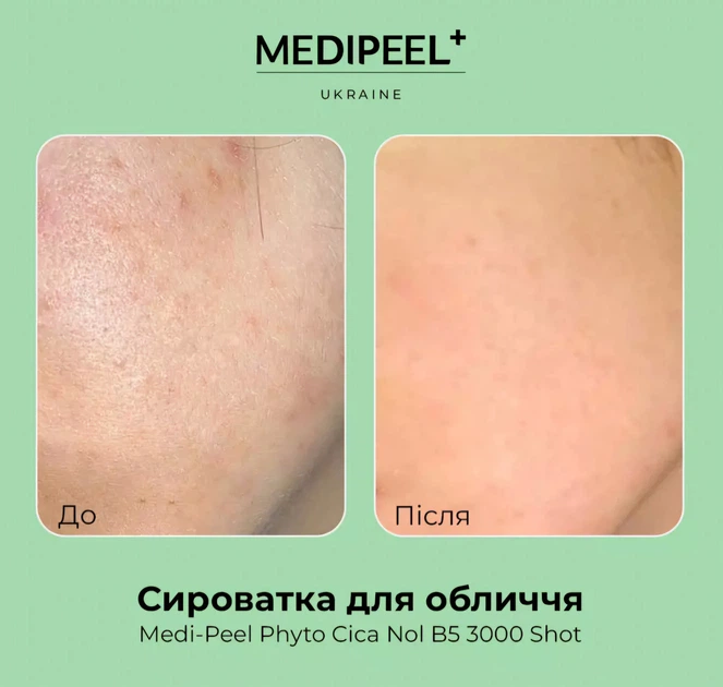 Cыворотка-пилинг со спикулами (микроиголками) для чувствительной и проблемной кожи лица Medi-Peel Phyto Cica-Nol B5 3000 Shot Serum, 50г - изображение 2