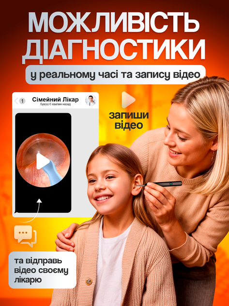 Прибор для чистки ушей удаления ушной серы с эндоскопической камерой отоскоп умная ушная палочка очиститель цифровой бытовой электронный для ушек Brillix NE6 с 4 силиконовыми ушными ложечками черный - изображение 3