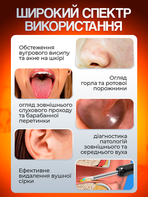 Прибор для чистки ушей удаления ушной серы с эндоскопической камерой отоскоп умная ушная палочка очиститель цифровой бытовой электронный для ушек Brillix NE6 с 4 силиконовыми ушными ложечками черный - изображение 4