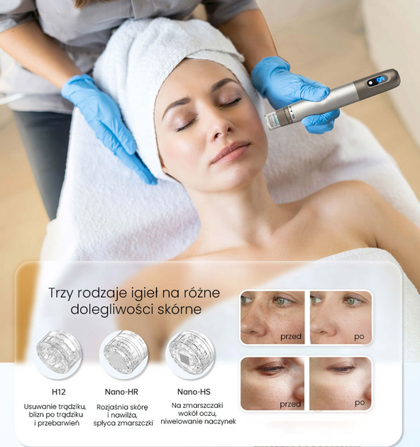 Urządzenie do mezoterapii mikroigłowej Beautifly SkinRenew Pro (5903003702573) - obraz 8