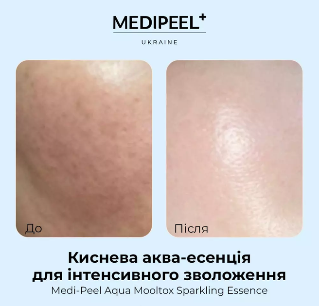 Інтенсивно зволожувальна есенція для обличчя Medi-Peel Aqua Mooltox Sparkling Essence, 100 мл - Фото 4 Інтенсивно зволожувальна есенція для обличчя Medi-Peel Aqua Mooltox Sparkling Essence, 100 мл - зображення 4