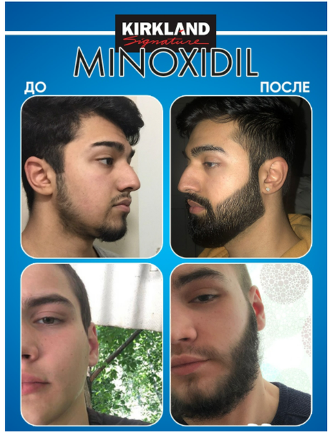 Набор для роста и ухода за бородой и усами Barbers, сыворотка ускоритель роста бороды, бальзам - изображение 4
