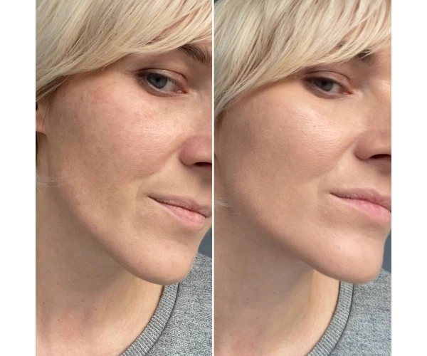 Професійний кушон зі SMART-пігментами Хедісон, що адаптується до теплого відтінку шкіри, Dr. HEDISON Miracle SPF 50/PA+++ , 15 г + 15 г (змінний блок) (12300002) - зображення 4