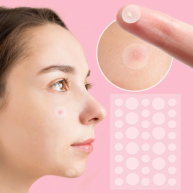 Патчі від прищів та акне 72 шт / Пластир косметичний для лікування акне Acne Patch (L) - Фото 2 Патчі від прищів та акне 72 шт / Пластир косметичний для лікування акне Acne Patch (L) - изображение 2
