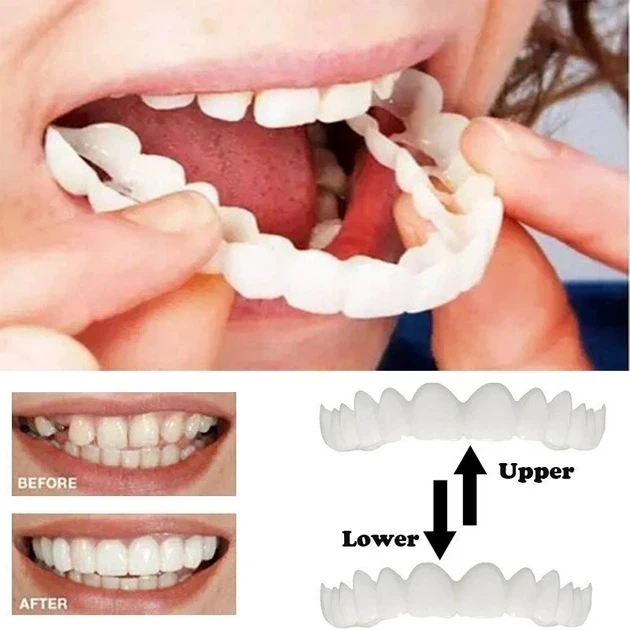 Знімні вініри для зубів Veneers smile, накладні зуби верх і низ у кейсі - зображення 7