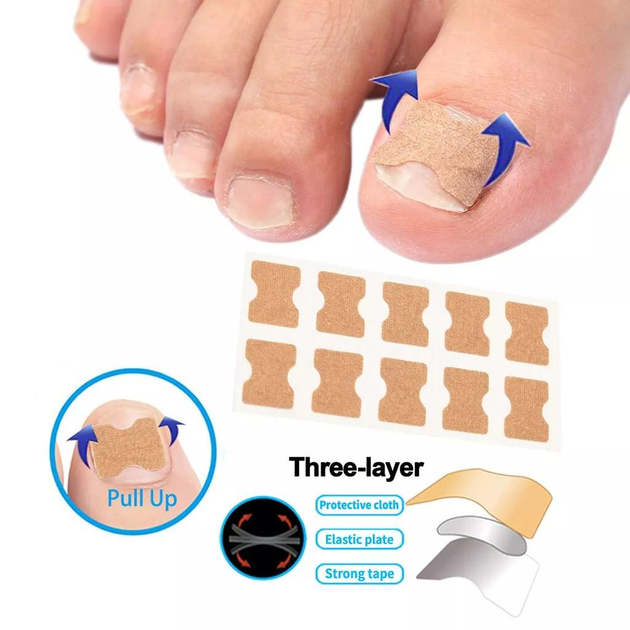 Набор пластырей для коррекции врастающих ногтей Elastic Toenail Correction Sticker 50 шт (2104618421) - изображение 2