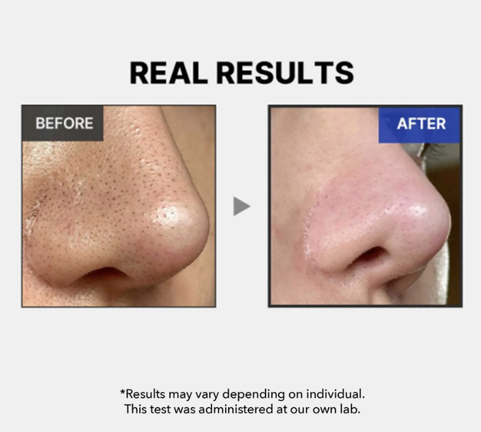 Сыворотка с экзосомами и спикулами для сужения пор Medicube One Day Exosome Shot Pore Ampoule 7500 30ml - изображение 6
