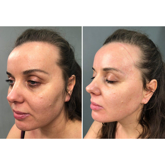 Мікрострумовий ліфтинг Medica+ Skin Lifting 5.0 - зображення 11