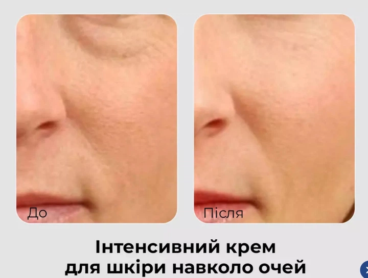 Антивіковий крем для повік MEDI PEEL PHYTO EXOSOME PDRN LIFTING SHOT EYE CREAM з фіто-екзосомами 40мл (5065) - зображення 2