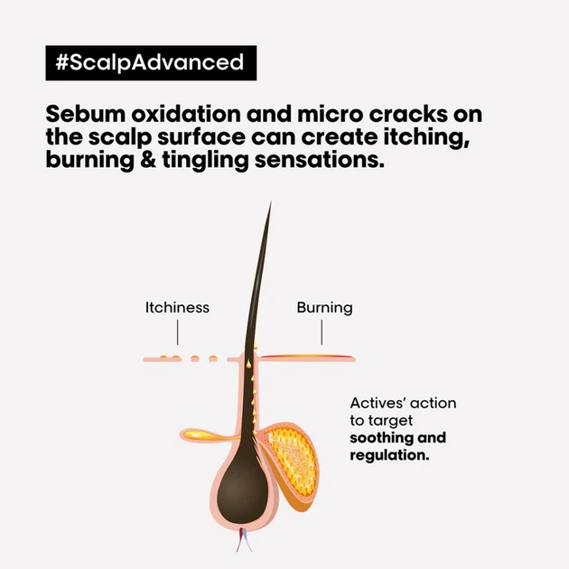 Шампунь для волос L'Oreal Paris Scalp Advanced Anti-Discomfort с ниацинамидом 500 мл (3474637090500) - Фото 4 Шампунь для волос L'Oreal Paris Scalp Advanced Anti-Discomfort с ниацинамидом 500 мл (3474637090500) - изображение 4