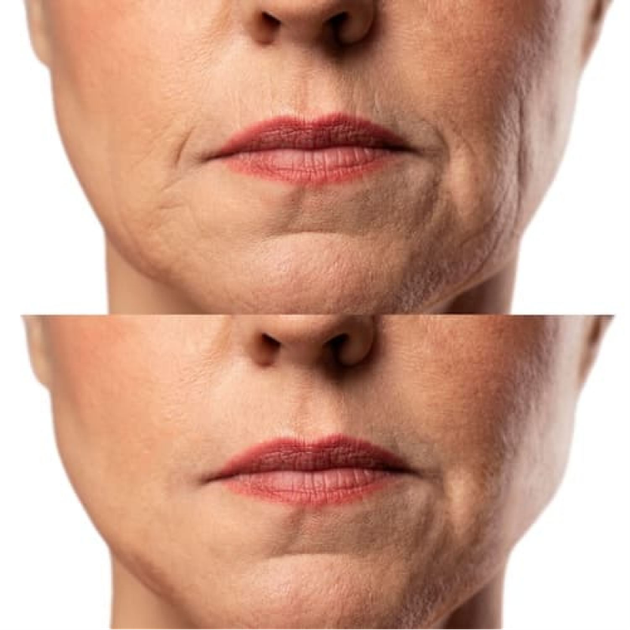 Микротоковый RF Lifting Массажер для лица Skin Lifting 7.0 Pink - EMS, LED - изображение 4