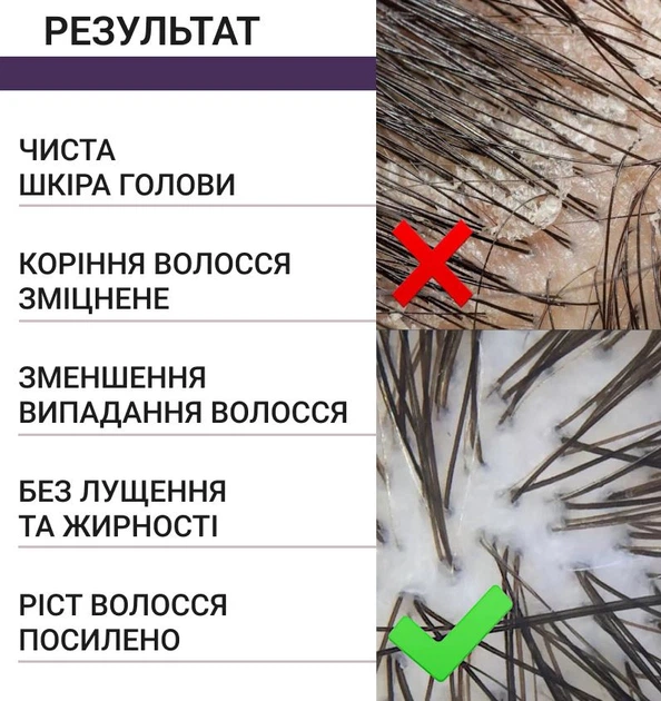 Скраб для шкіри голови з кератином для очищення, росту та зміцнення волосся Reclaire 200 мл - зображення 4