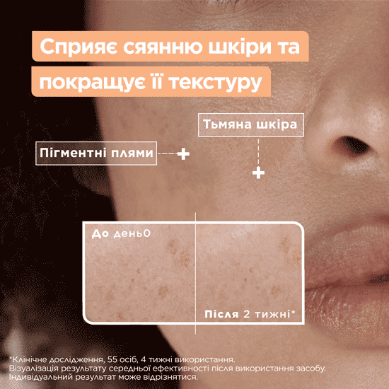 Сыворотка Mixa для Сияния тусклой чувствительной кожи лица 30 мл (3600551136936) - Фото 3 Сыворотка Mixa для Сияния тусклой чувствительной кожи лица 30 мл (3600551136936) - изображение 3