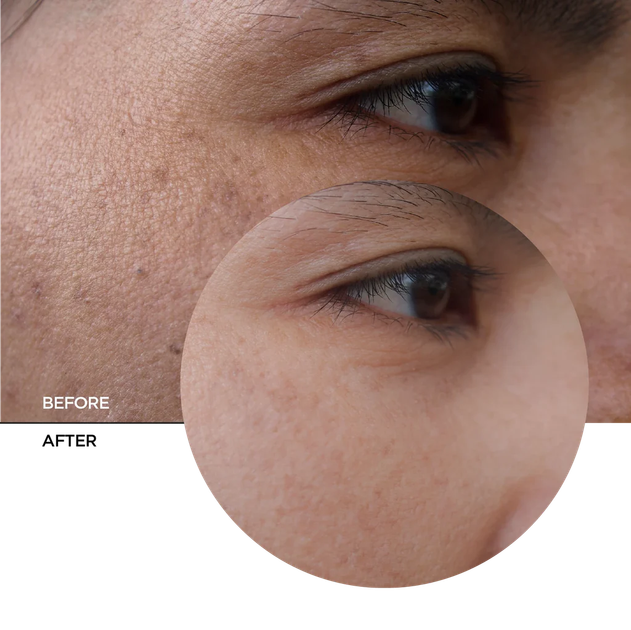Krem-żel nawilżający do twarzy Revox Skintreats 50 ml (5060565107526) - obraz 5