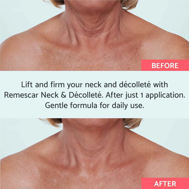 Крем для шиї та декольте Remescar Neck and Décolleté від зморшок 40 мл (5425012535923) - зображення 4