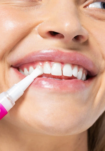 Відбілювальний олівець для зубів SmileKit PAP+ 3 мл (5.155) - зображення 4