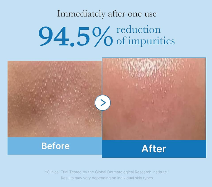 Гидрофильное масло для глубокой очистки пор Medicube Zero Pore Blackhead Deep Cleansing Oil 205ml - изображение 6