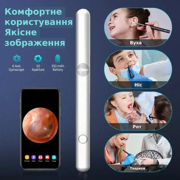 Отоскоп акумуляторний DCAEMAK Р50, з камерою для детального огляду та ефективного видалення сірки, білий - зображення 2