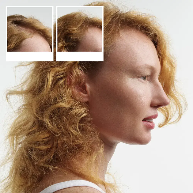 Набір для догляду за волоссям Nioxin System 1 Scalp+ протидія легкому витонченню Шампунь 150 мл + Кондиціонер 150 мл + Спрей 50 мл (4064666843889) - зображення 3