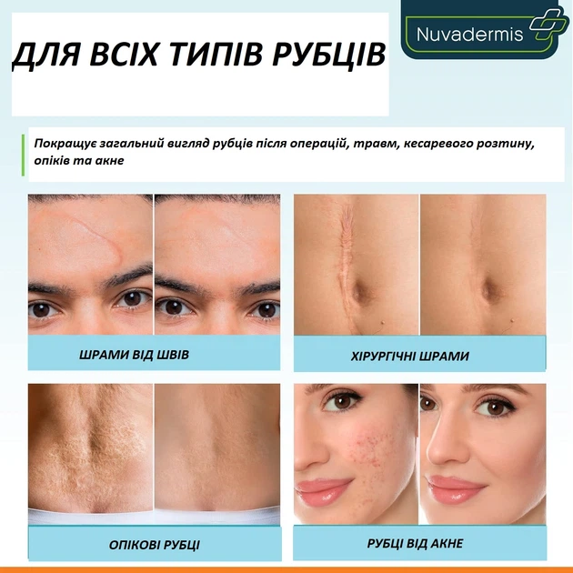 Набор от шрамов Nuvadermis Scar Care Bundle гель и пластырь - изображение 4