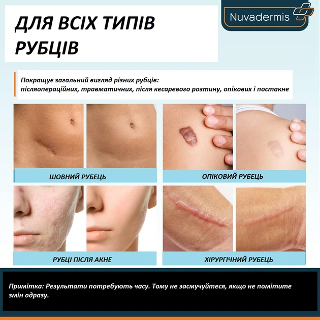 Набор от шрамов Nuvadermis Scar Care Bundle гель и пластырь - изображение 7