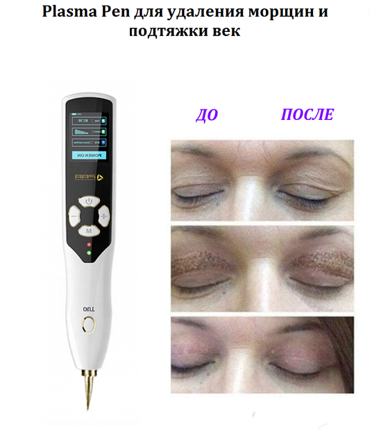 Аппарат холодной плазмы Plasma Pen AURO PAA 2000 для удаления морщин, пигментных пятен, акне (0151) - изображение 8