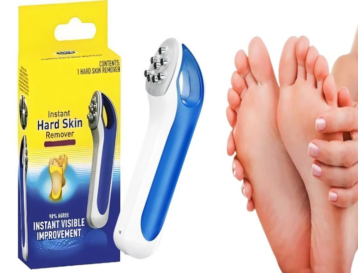 Скребок-пемза для пяток TV One Scholl Instant Hard Skin Remover Щетка-терка для чистки пяток скребок для педикюра (7164) - Фото 3 Скребок-пемза для пяток TV One Scholl Instant Hard Skin Remover Щетка-терка для чистки пяток скребок для педикюра (7164) - изображение 3