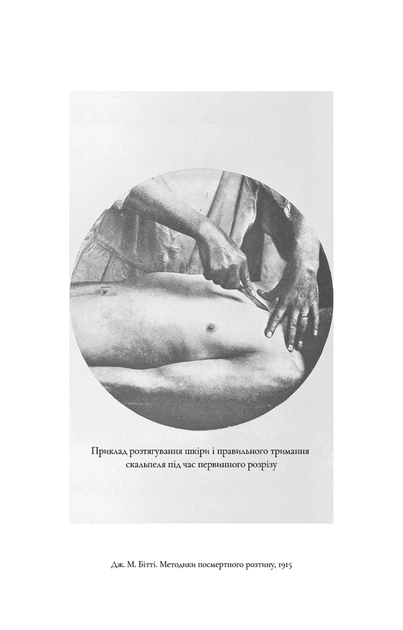 По сліду Джека-Різника. Книга 1 - изображение 5