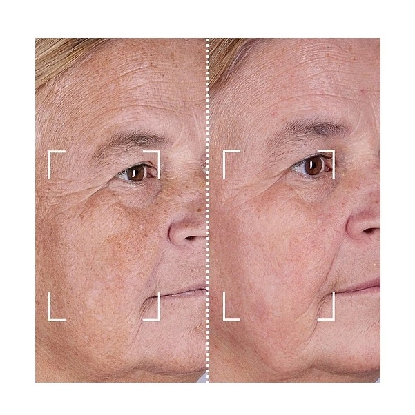 Набор CurrentBody Skin LED Light Therapy Face Neck Kit: Series 2 для лица, шеи и зоны декольте - изображение 7