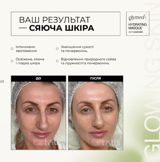 GlyMed Plus Hydrating Masque with Enzymes – Ультразволожувальна ферментна маска з ензимами, 30 мл - Фото 4 GlyMed Plus Hydrating Masque with Enzymes – Ультразволожувальна ферментна маска з ензимами, 30 мл - зображення 4