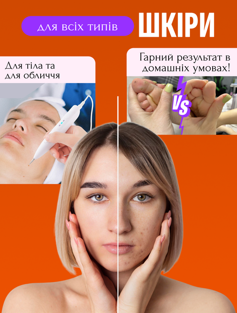 Электрокоагулятор плазменный косметологический прибор коагулятор для удаления родинок папиллом бородавок тату веснушек пигментных пятен элетро плазменная ручка Mini Freckle многофункциональный аппарат безболезненное коагулирование тканей электрокоагуагуля - Фото 4 Электрокоагулятор плазменный косметологический прибор коагулятор для удаления родинок папиллом бородавок тату веснушек пигментных пятен элетро плазменная ручка Mini Freckle многофункциональный аппарат безболезненное коагулирование тканей электрокоагуагуля - изображение 4