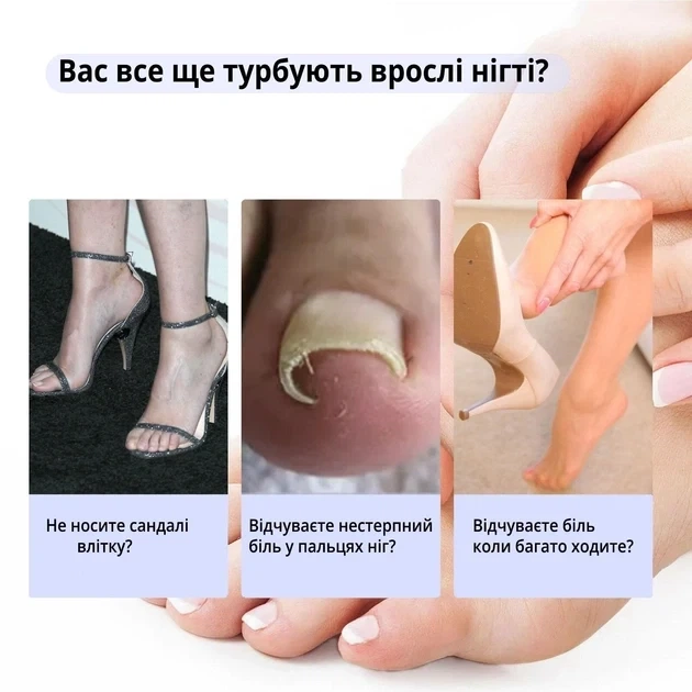 Набор пластырей Elastic Toenail Correction Sticker для коррекции и устранения вросших ногтей (50 шт.) - изображение 5
