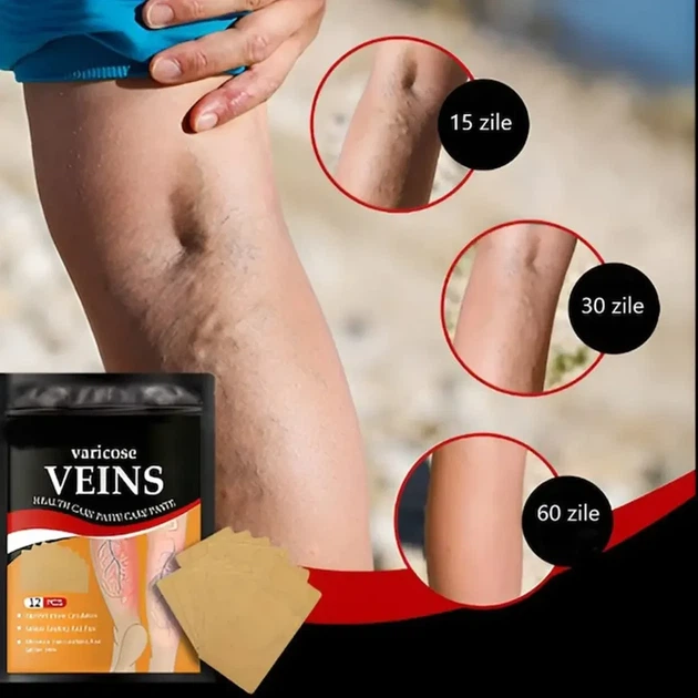 Пластырь от варикозного расширения вен (12 шт) Veins Patch - изображение 4